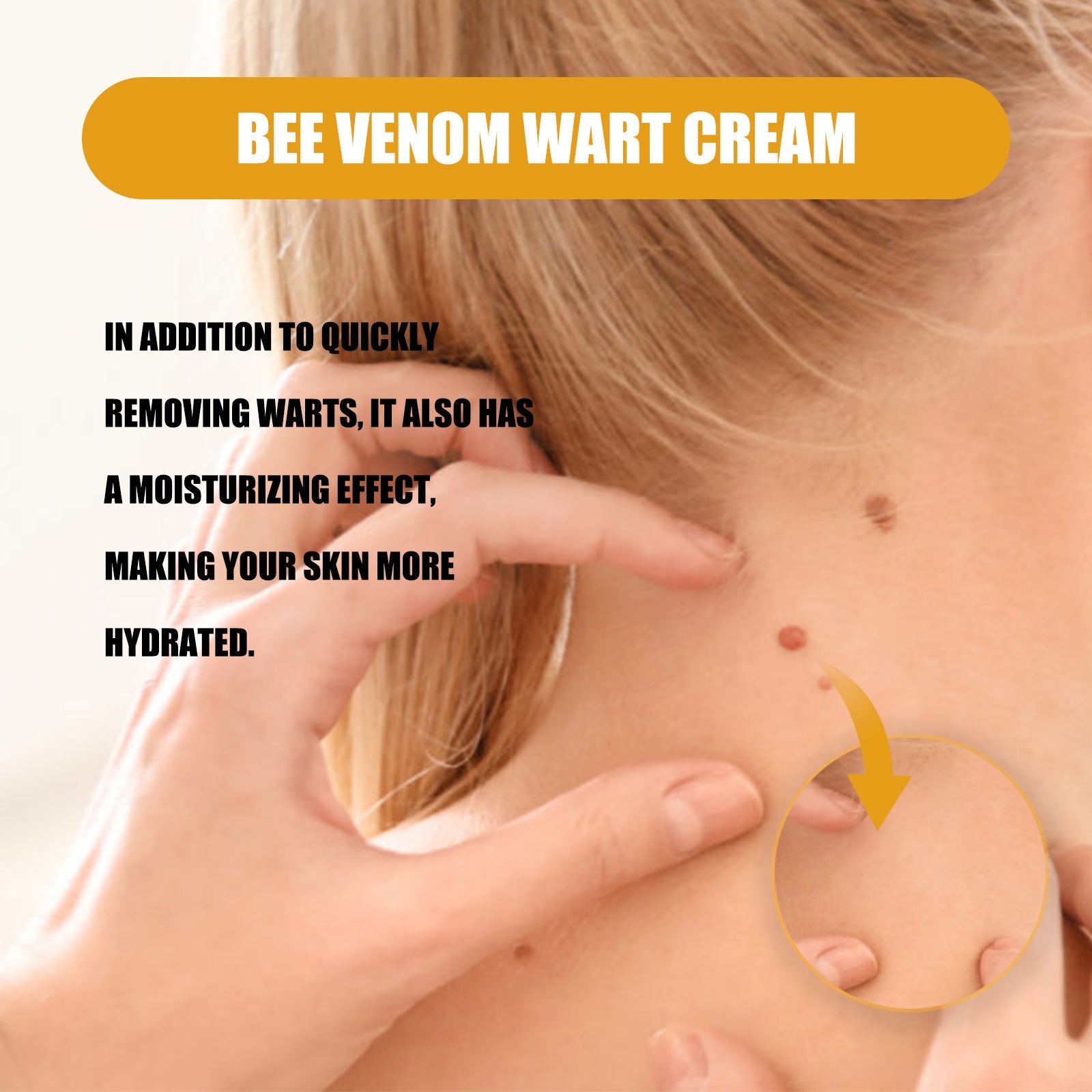 Ximonth Bee Venom Wart Repair Cream - NurturePathWellness