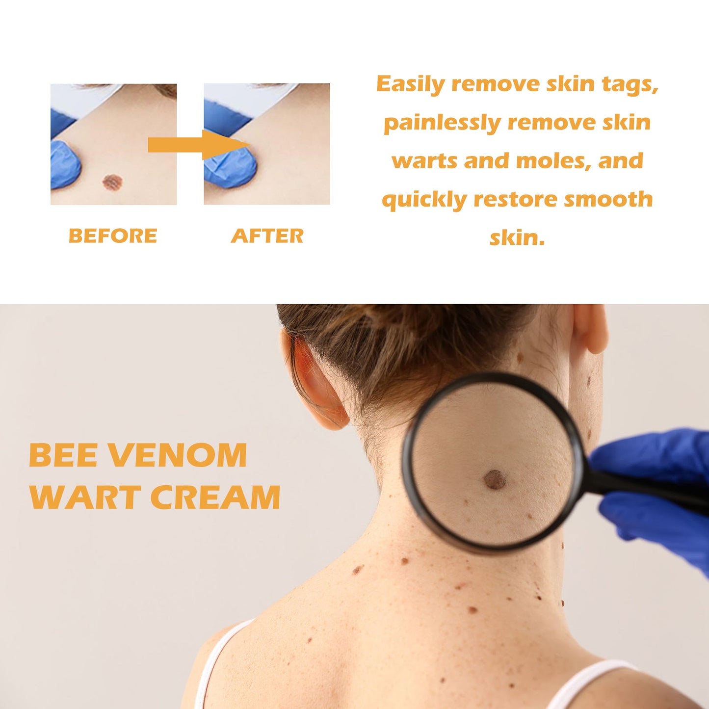 Ximonth Bee Venom Wart Repair Cream - NurturePathWellness