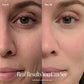 4-in-1 Red Light Therapy Wand & Activating Serum Kit Solawave